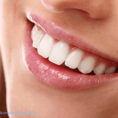 zirkonyum dis kaplama dis hastanesi