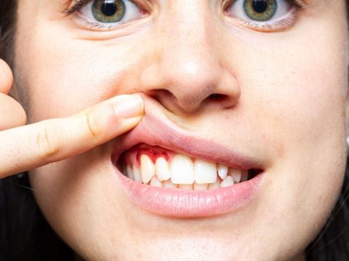 Dis-Eti-Kanamasi (3) Dis-Eti-Kanamasi